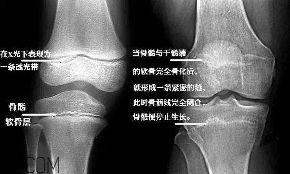 孩子学街舞好不好？学街舞好处多多