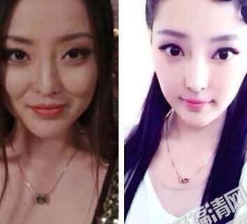 王洁曦整容前的样子(王洁曦遗体遗容)